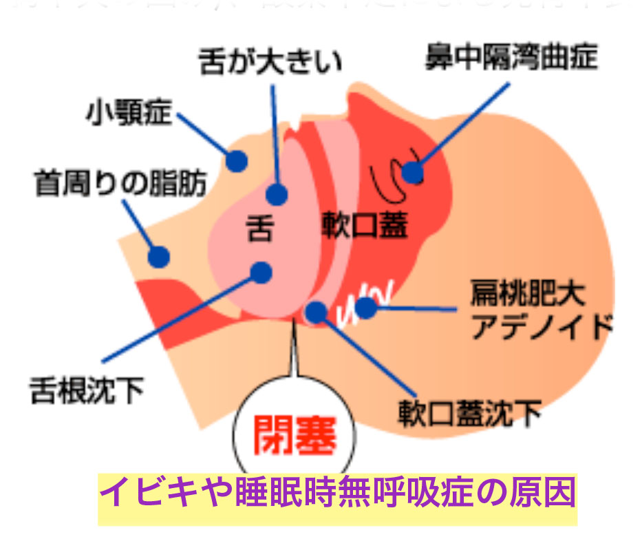 ibiki