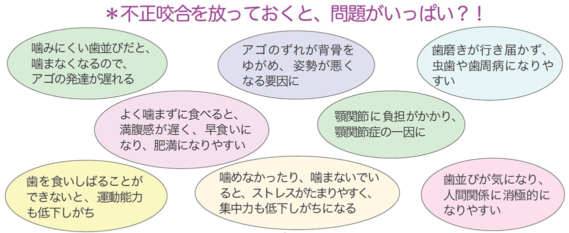 不正咬合による問題