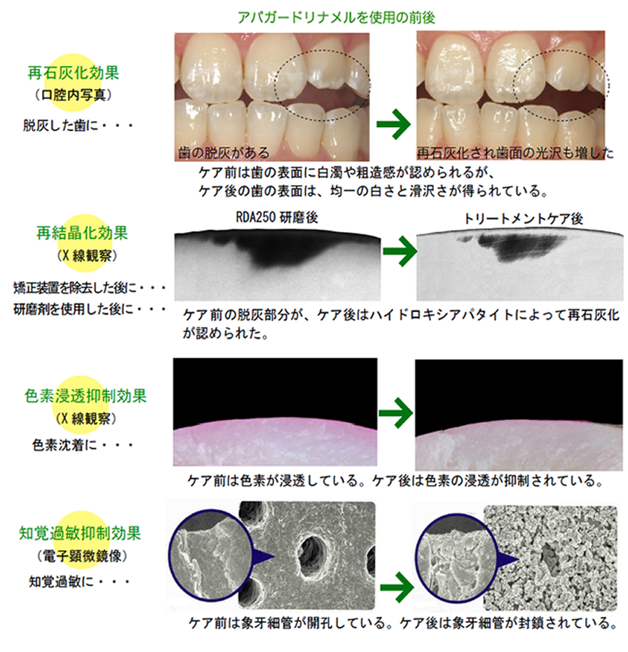 トリートメントケアの施術例