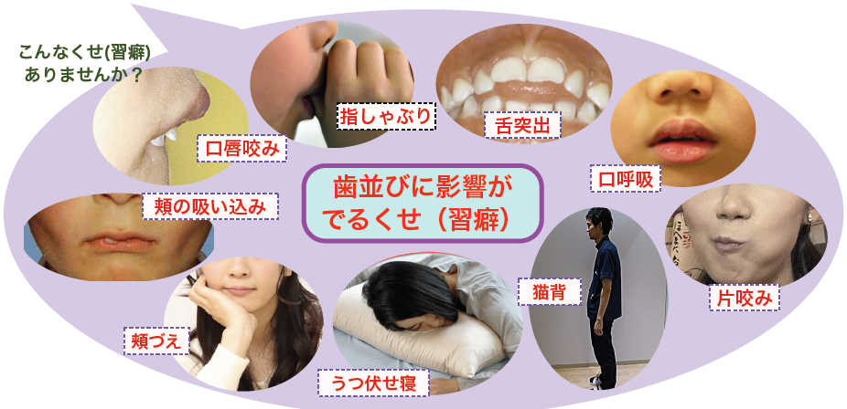 くせ 習癖 と歯並びの関係 横浜市の矯正専門歯科 福増矯正歯科
